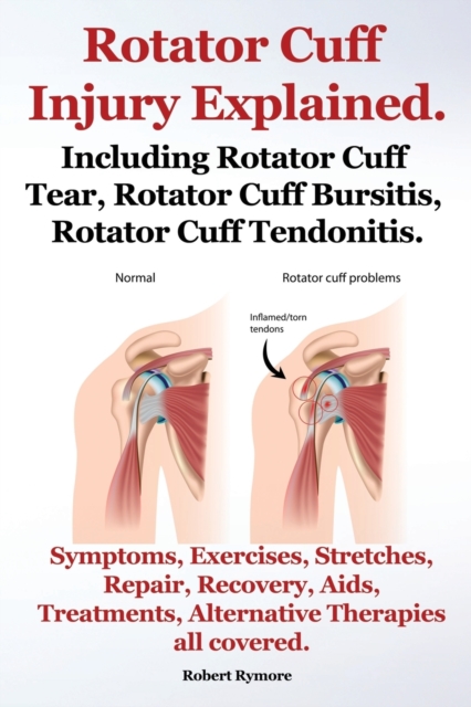 Rotator Cuff Injury Explained. Including Rotator Cuff Tear, Rotator Cuff Bursitis, Rotator Cuff Tendonitis. Symptoms, Exercises, Stretches, Repair, Recovery, Aids, Treatments, Alternative Therapies al, Paperback / softback Book