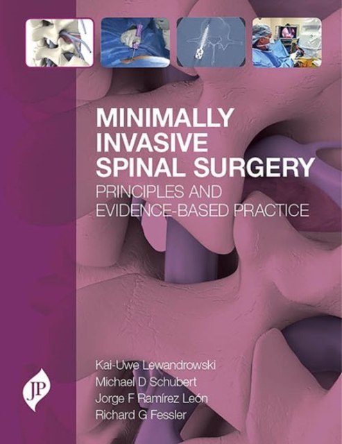 Minimally Invasive Spinal Surgery : Principles and Evidence-Based Practice, Hardback Book