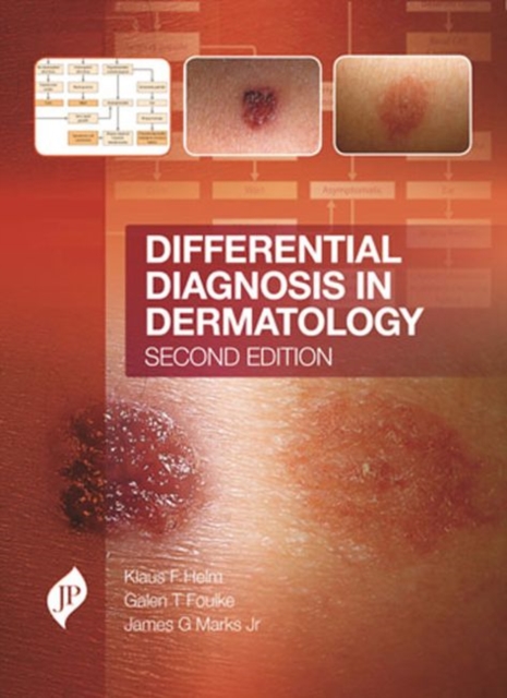 Differential Diagnosis in Dermatology, Hardback Book