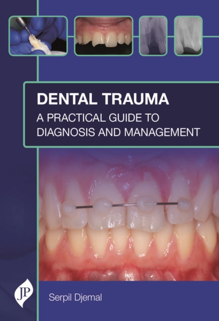 Dental Trauma : A Practical Guide to Diagnosis and Management, Hardback Book