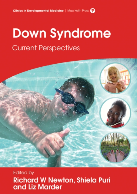 Down Syndrome : Current Perspectives, EPUB eBook