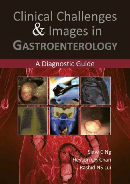 Clinical Challenges & Images in Gastroenterology : A Diagnostic Guide, Paperback / softback Book
