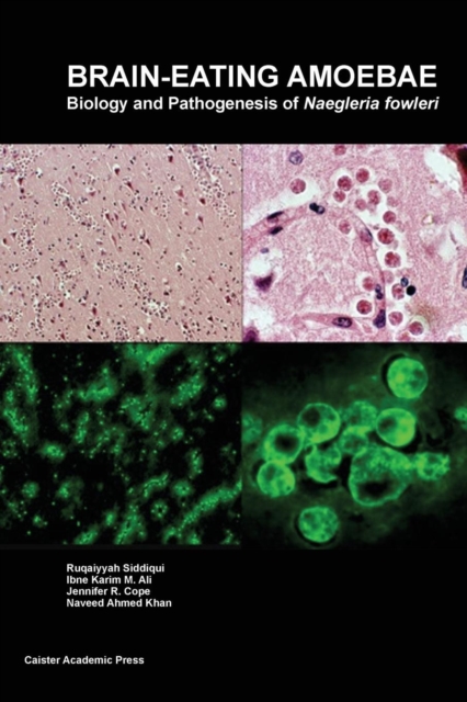 Brain-Eating Amoebae : Biology and Pathogenesis of Naegleria Fowleri, Paperback / softback Book