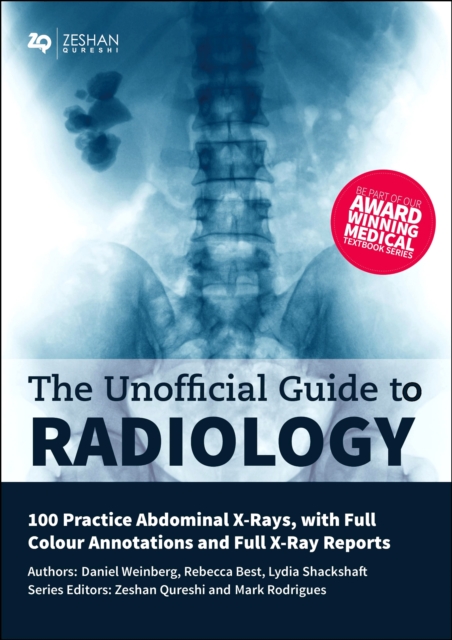 Unofficial Guide to Radiology: 100 Practice Abdominal X Rays with Full Colour Annotations and Full X Ray Reports, Paperback / softback Book