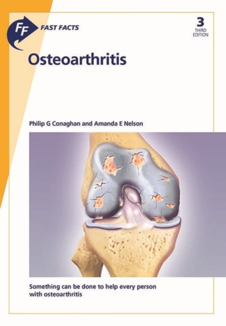 Fast Facts: Osteoarthritis, Paperback / softback Book