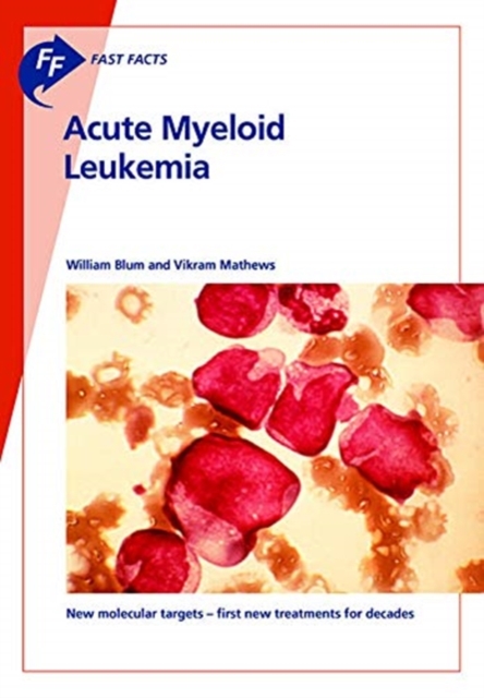 Fast Facts: Acute Myeloid Leukemia, Paperback / softback Book