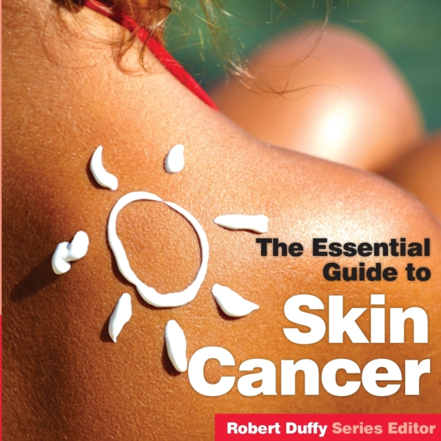 The Essential Guide to Skin Cancer, Paperback / softback Book