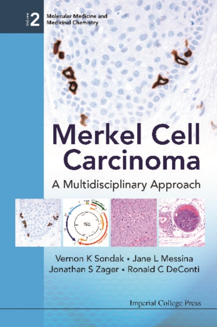 Merkel Cell Carcinoma: A Multidisciplinary Approach, PDF eBook