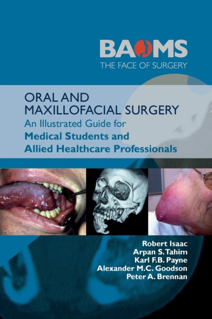 ORAL AND MAXILLOFACIAL SURGERY : An Illustrated Guide for Medical Students and Allied Healthcare Professionals, Paperback / softback Book