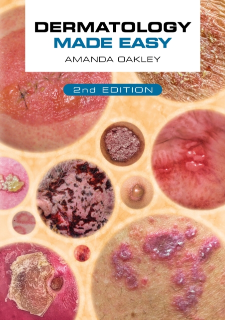 Dermatology Made Easy, second edition, Paperback / softback Book
