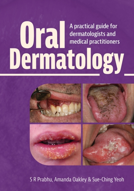 Oral Dermatology : A practical guide for dermatologists and medical practitioners, Hardback Book