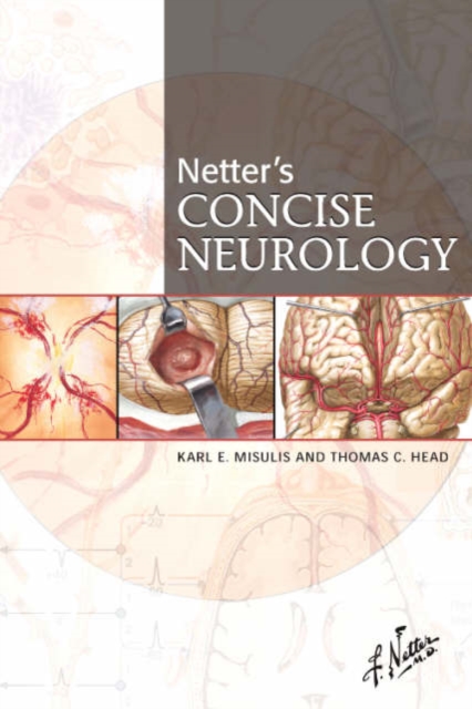 Netter's Concise Neurology, Paperback Book