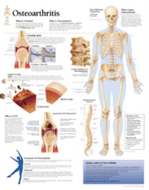 Osteoarthritis Paper Poster, Poster Book