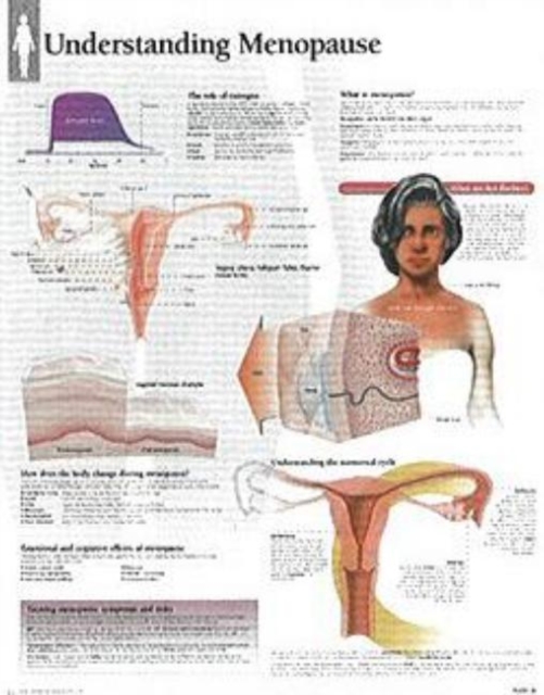 Understanding Menopause Laminated Poster, Poster Book