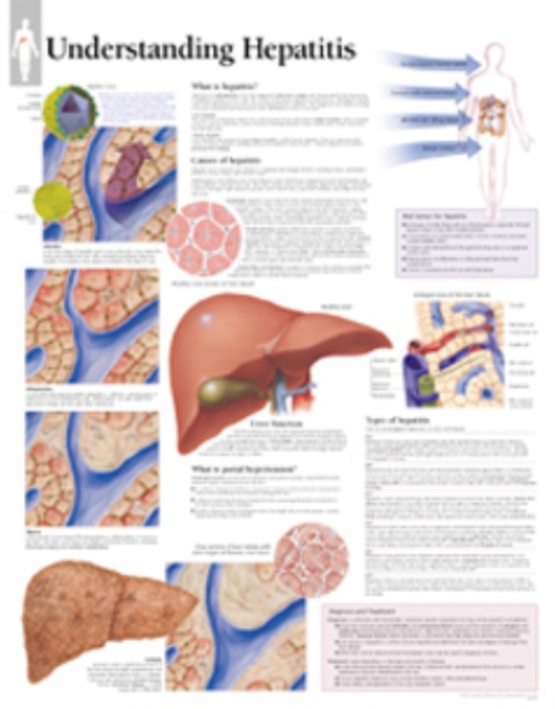 Understanding Hepatitis Laminated Poster, Poster Book
