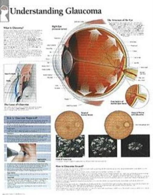 Understanding Glaucoma Paper Poster, Poster Book
