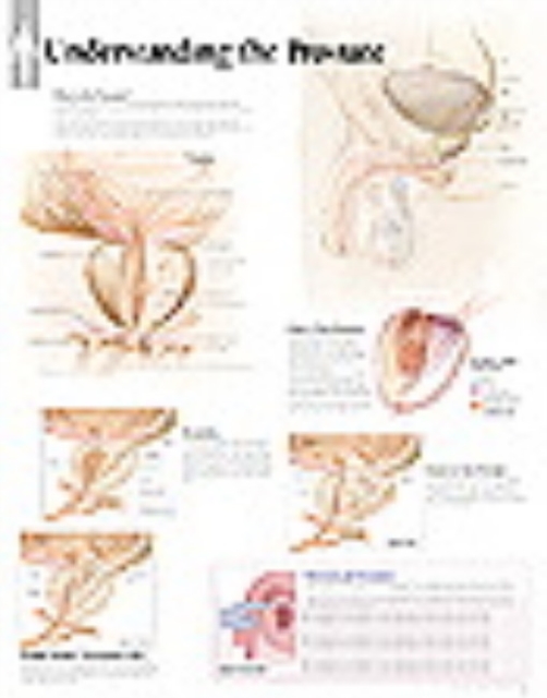Understanding the Prostate Paper Poster, Poster Book