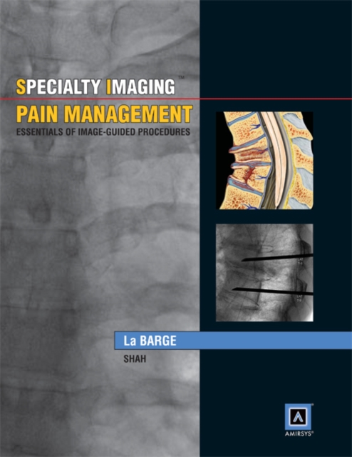 Specialty Imaging: Pain Management: Essentials of Image-guided Procedures, Hardback Book