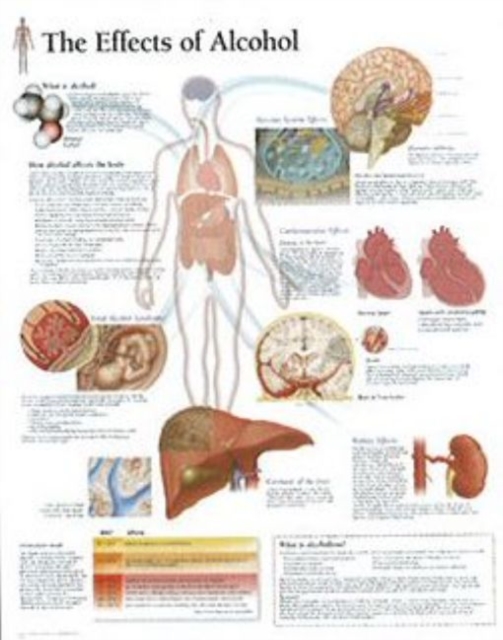 Effects of Alcohol Laminated Poster, Poster Book