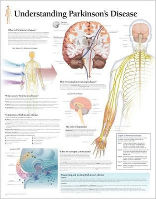 Understanding Parkinson's Laminated Poster, Poster Book