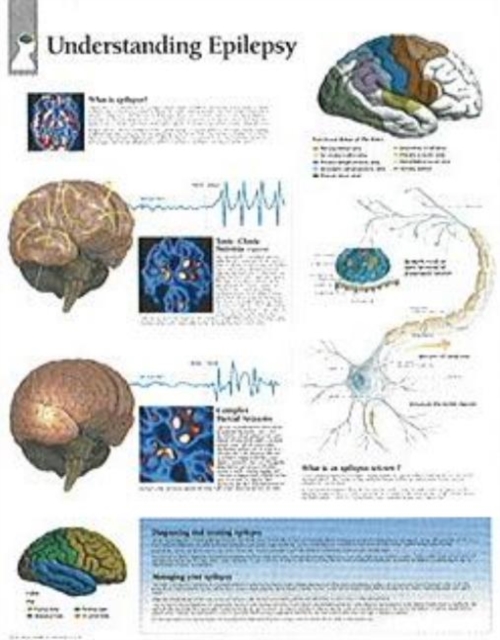 Understanding Epilepsy Laminated Poster, Poster Book