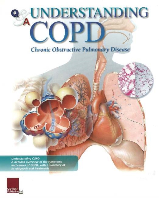 Understanding COPD Flip Chart, Spiral bound Book