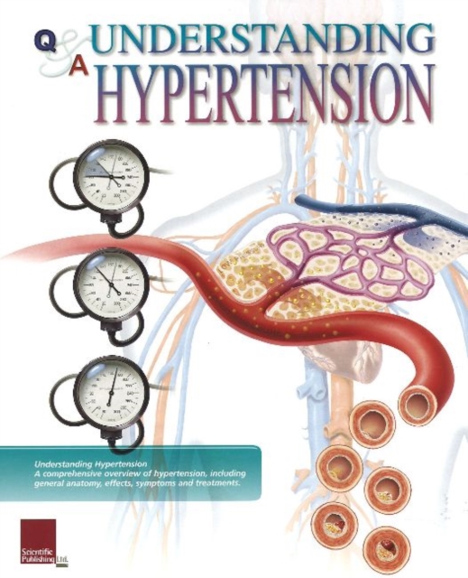 Understanding Hypertension Flip Chart, Spiral bound Book