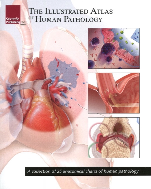 Illustrated Atlas of Human Pathology : A Collection of 25 Anatomical Charts of Human Pathology, Paperback / softback Book