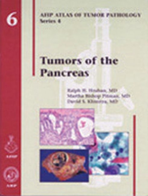 Tumors of the Pancreas, Hardback Book