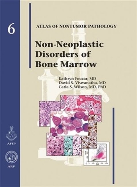 Non-Neoplastic Diseases of Bone Marrow, Hardback Book