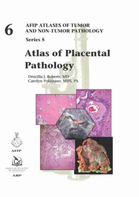 Atlas of Placental Pathology, Hardback Book