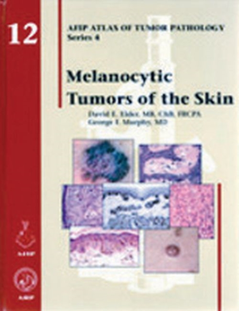 Melanocytic Tumors of the Skin, Hardback Book