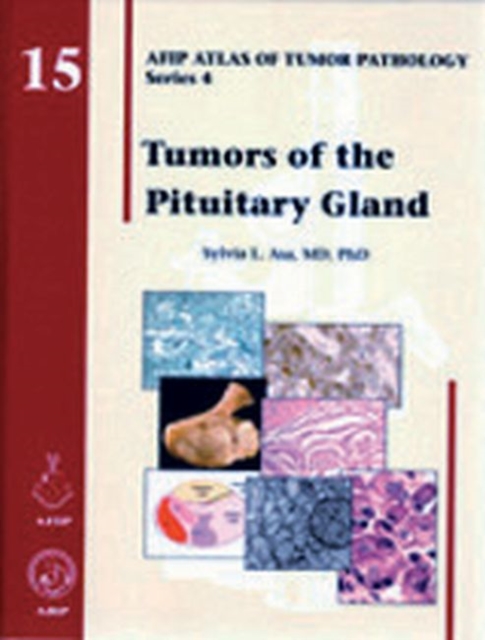 Tumors of the Pituitary Gland, Hardback Book