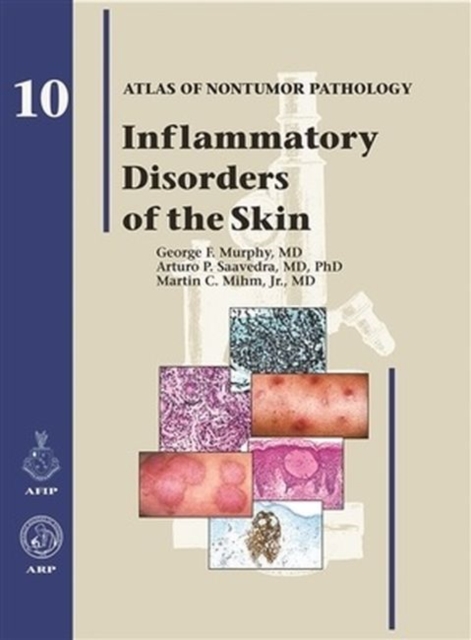 Inflammatory Disorders of the Skin, Hardback Book