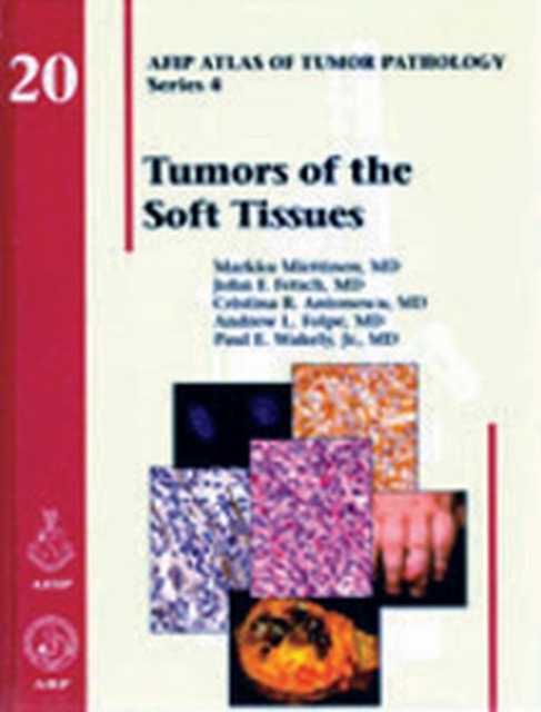 Tumors of the Soft Tissues, Hardback Book