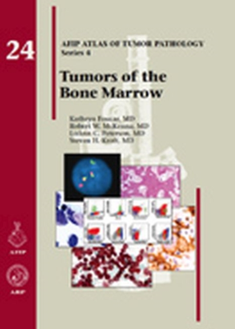 Tumors of the Bone Marrow, Hardback Book