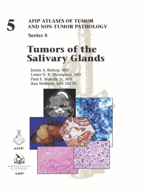 Tumors of the Salivary Glands, Hardback Book