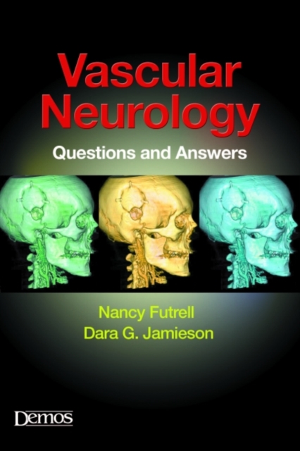 Vascular Neurology : Questions and Answers, Paperback / softback Book