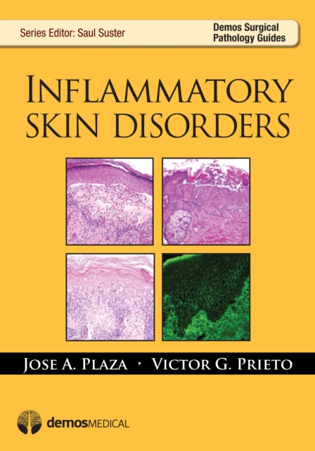 Inflammatory Skin Disorders, Paperback / softback Book