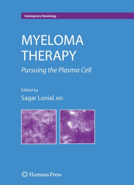 Myeloma Therapy : Pursuing the Plasma Cell, Hardback Book