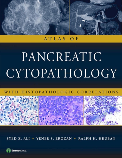 Atlas of Pancreatic Cytopathology : With Histopathologic Correlations, PDF eBook