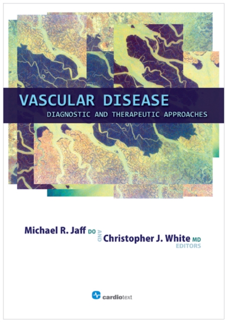 Vascular Disease : Diagnostic and Therapeutic Approaches, PDF eBook