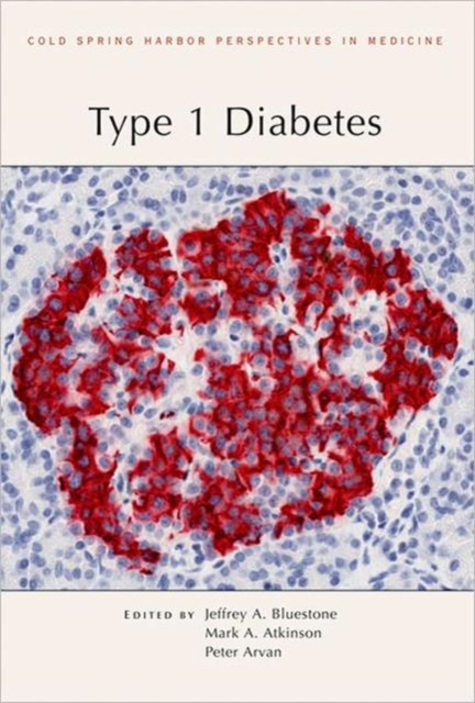 Type 1 Diabetes, Hardback Book