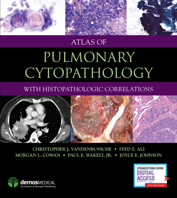 Atlas of Pulmonary Cytopathology, Hardback Book