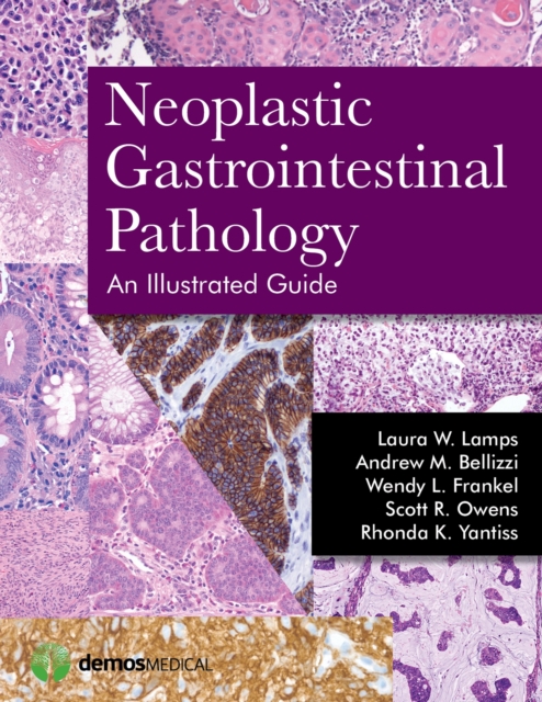 Neoplastic Gastrointestinal Pathology : An Illustrated Guide, Hardback Book