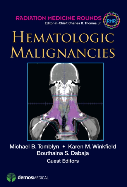 Hematologic Malignancies, Hardback Book