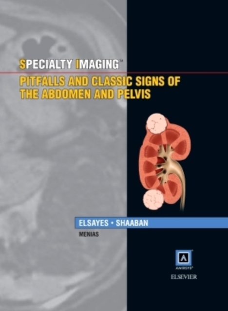 Specialty Imaging: Pitfalls and Classic Signs of the Abdomen and Pelvis, Hardback Book