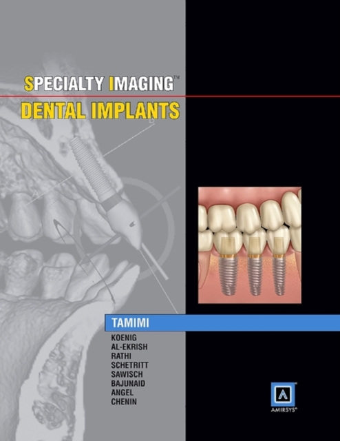 Specialty Imaging: Dental Implants, Hardback Book