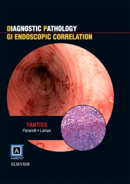 Diagnostic Pathology: GI Endoscopic Correlations, Hardback Book