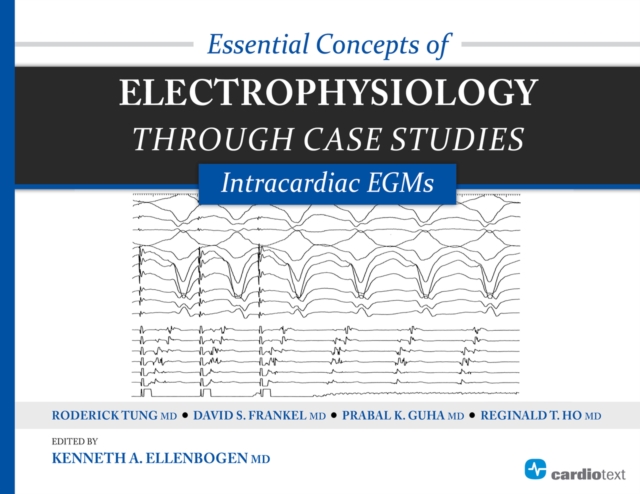 Essential Concepts of Electrophysiology through Case Studies: Intracardiac EGMs : Intracardiac EGMs, PDF eBook